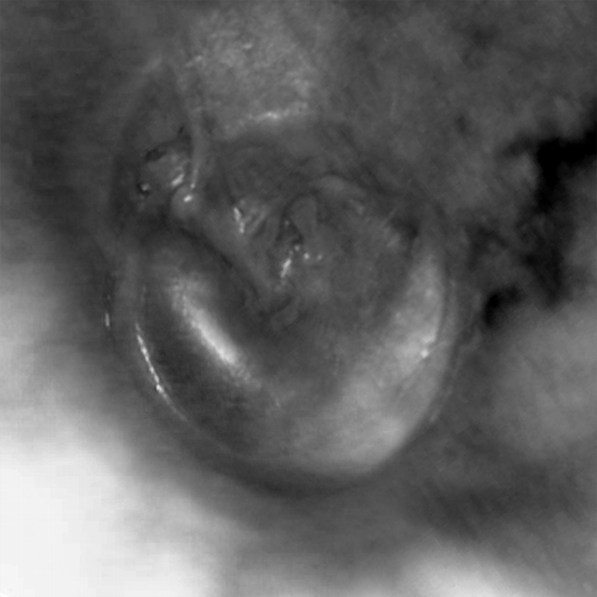 Heiko Wommelsdorf – Trommelfelle